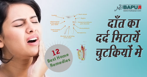 अब दाँत का दर्द मिटायें चुटकियों मे(आसान असरकारक घरेलू उपचार) | Simple Remedies for Toothache Relief