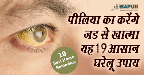 138-Jaundice-Treatment-in-Hindi,पीलिया (Jaundice),piliya ka ilaj,घरेलू उपाय(home remedies),