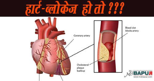 हार्ट-ब्लोकेज हो तो ??? | Heart block diagnosis and treatment