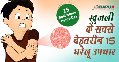घरेलु नुस्खे(Home remedies),खुजली(Itching) ,Eczema,Khujli Ka Desi aur Gharelu ilaj ,दाद खाज(daad khaaj) ,Scabies ,Pruritus