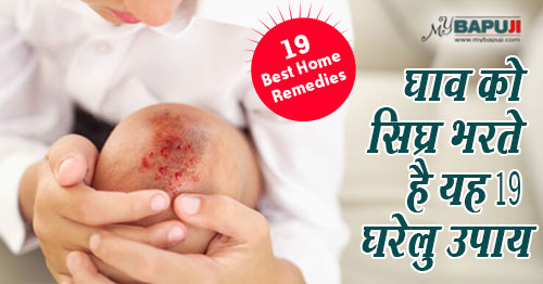 घरेलु उपाय(Home remedies),चोट(Chot)(INJURY),घाव ghav(wound),