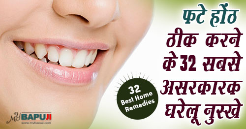 फटे होंठ ठीक करने के 32 अचूक घरेलू नुस्खे और उपाय - Fate Honth ke Gharelu Upay