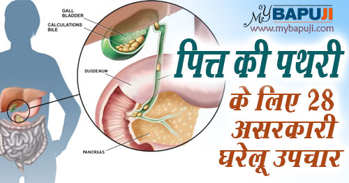 पित्त की पथरी के लिए 28 असरकारी घरेलू उपचार | Best Natural Remedies for Gallstones in hindi