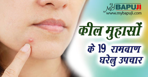 keel muhase pimples treatment in hindi