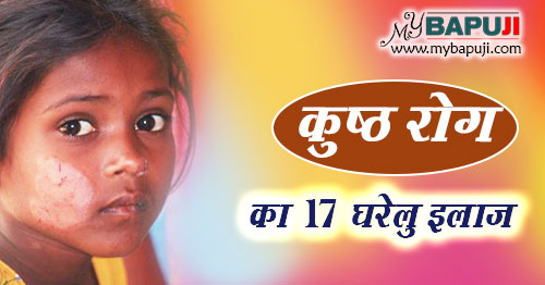 कुष्ठ (कोढ़) रोग का 17 घरेलु इलाज | kusht rog ka gharelu ilaj