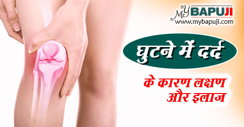 घुटने के दर्द का घरेलू इलाज | Knee Pain Home Remedy in Hindi