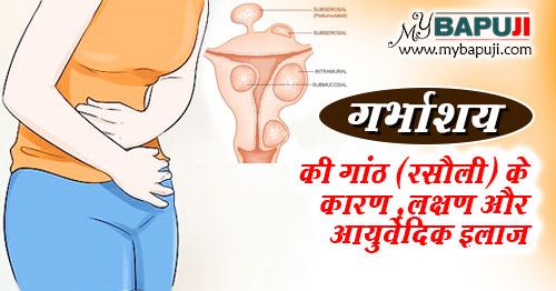 गर्भाशय की गांठ (रसौली) का आयुर्वेदिक इलाज - Garbhashay ki Ganth ka Ayurvedic Ilaj in Hindi