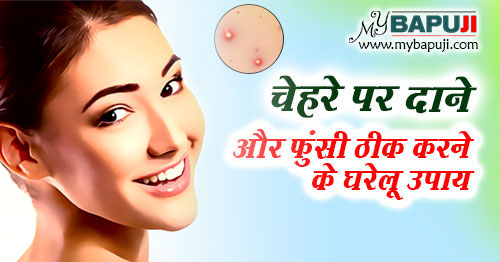 चेहरे पर दाने और फुंसी ठीक करने के उपाय ,इलाज और दवा | Face Par Dane Hatane Ke Upay in Hindi