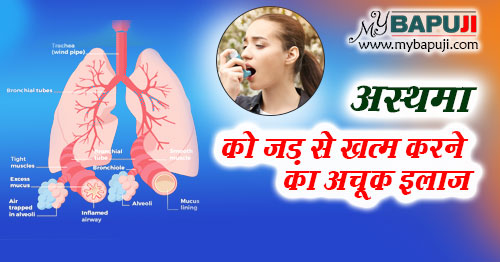 अस्थमा का इलाज ,आयुर्वेदिक दवा उपाय और घरेलू नुस्खे  | Asthma ke Karan Lakshan aur ilaj