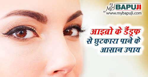 आइब्रो के डैंड्रफ से छुटकारा पाने के आसान उपाय | Eyebrow Dandruff Treatment In Hindi