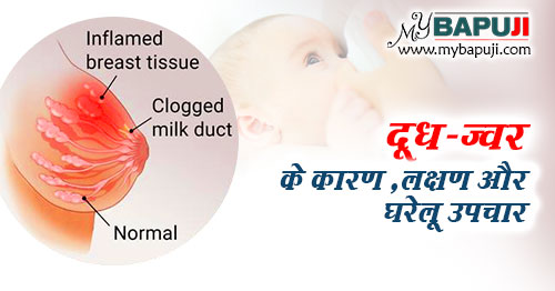 दूध-ज्वर के कारण ,लक्षण और घरेलू उपचार | Milk Fever-Symptoms and Causes