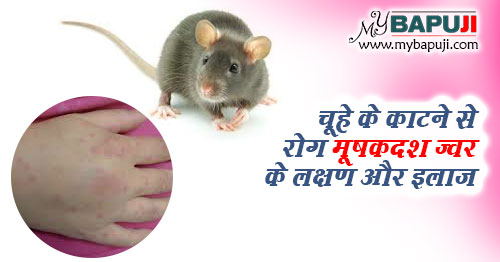 चूहे के काटने से रोग मूषकदश ज्वर के लक्षण और इलाज