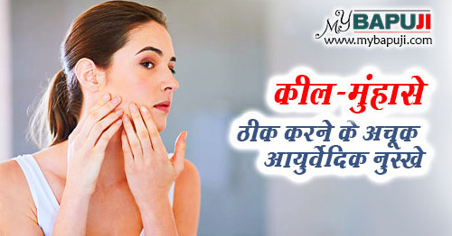 कील-मुंहासे ठीक करने के अचूक आयुर्वेदिक नुस्खे | Ayurveda Remedies for Pimples