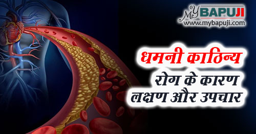 Arteriosclerosis in Hindi धमनी काठिन्य के लक्षण कारण दवा और इलाज