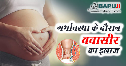 गर्भावस्था के दौरान बवासीर (पाइल्स) का इलाज दवा और बचाव के उपाय