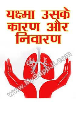 Yaksma Uskai Karn Aur Nivaran Hindi PDF Free Download