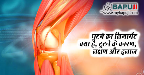 घुटने का लिगामेंट क्या है, टूटने के कारण,लक्षण और इलाज - Ghutne ka Ligament kya hai, Tutne ke Karan, Lakshan aur Ilaj in Hindi