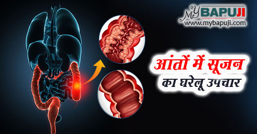 आंत की सूजन (आंत्रशोथ) का घरेलू उपचार - Ulcerative Colitis Home Remedies in Hindi