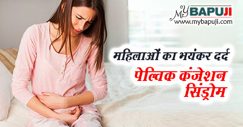 महिलाओं का भयंकर दर्द पेल्विक कंजेशन सिंड्रोम (Pelvic Congestion Syndrome in Hindi)