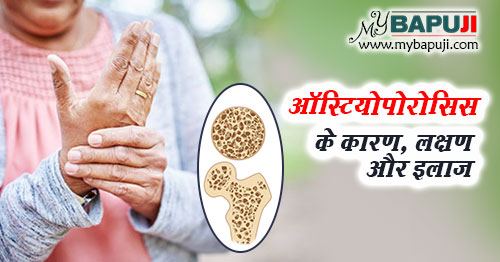 osteoporosis karan lakshan aur bachne ke upay in hindi