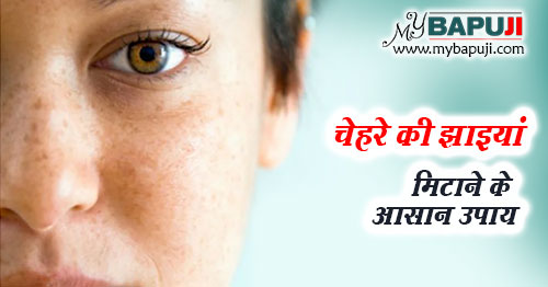 चेहरे की झाइयां मिटाने के 13 आसान उपाय - Chehre ki Chaiyan Hatane ka Tarika in Hindi