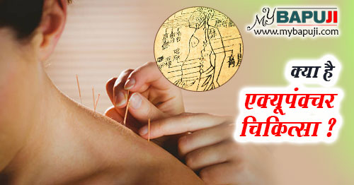 Acupuncture kya hai aur iske Fayde in Hindi