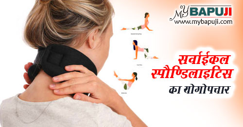 cervical spondylosis ka yog dwara upchar in hindi