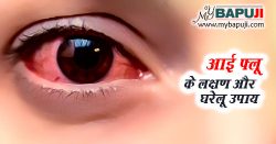आई फ्लू के लक्षण, कारण और घरेलू उपचार - Eye Flu Ke Karan, Lakshan Aur