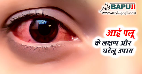 Eye Flu ke Karan Lakshan aur Upchar in Hindi
