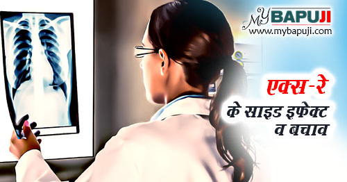 X ray ke Nuksan aur Bachav in Hindi