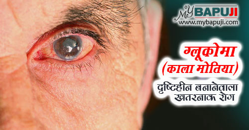 all about Glaucoma kala motia in hindi