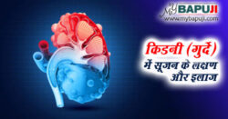 किडनी (गुर्दे) में सूजन के लक्षण और इलाज - Kidney Me Sujan Ke Lakshan