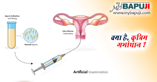 क्या है, कृत्रिम गर्भाधान - Kritim Garbhadhan Kya Hai