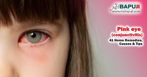 Pink eye (conjunctivitis) 41 Home Remedies Causes & Tips
